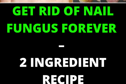 GET RID OF NAIL FUNGUS FOREVER – 2 INGREDIENT RECIPE