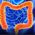 What Is Colorectal Cancer (Rectum)?
