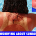 Stop worrying about sunburns