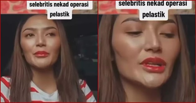 Sering digunjing wajahnya operasi plastik, begini reaksi kocak Siti Badriah bareng sang suami