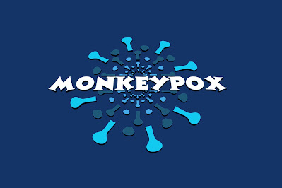 Monkeypox virus; History, Symptoms, causes, and treatment