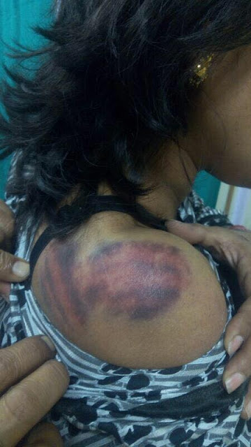 Anu Jain, a Delhi High Court advocate was brutally beaten with iron rods. 