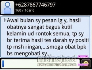 Cara Menghilangkan Mata Ikan Di Telapak Kaki