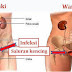 Obat Apotik untuk Kencing Nanah Yang Manjur