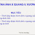 Hình ảnh X Quang U xương - ThS Chu Văn Đặng [PDF]