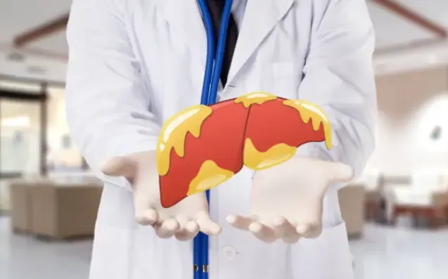The Ultimate Guide to Understanding Fatty Liver