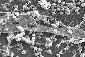 biofilm, operasi implan, pemasangan implan