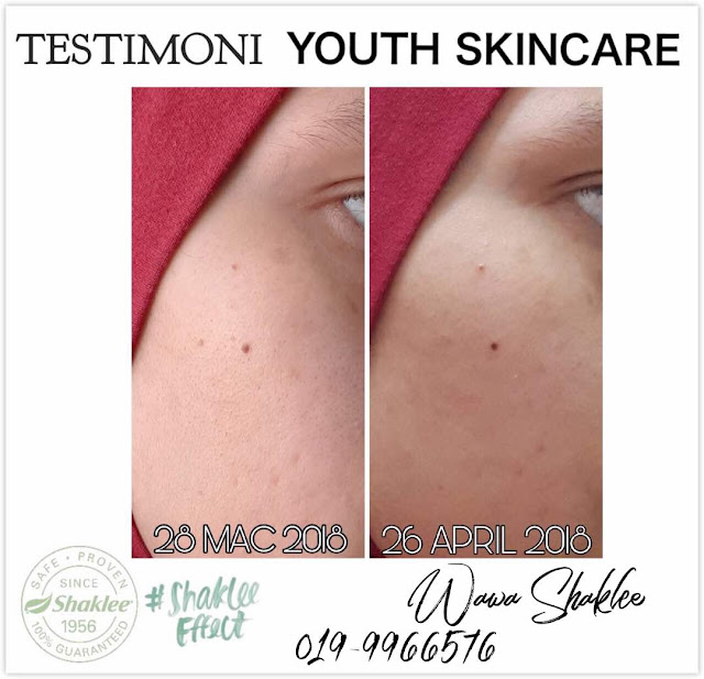 Testimoni Youth Skincare Shaklee, Youth Skincare, Youth Skincare Semulajadi