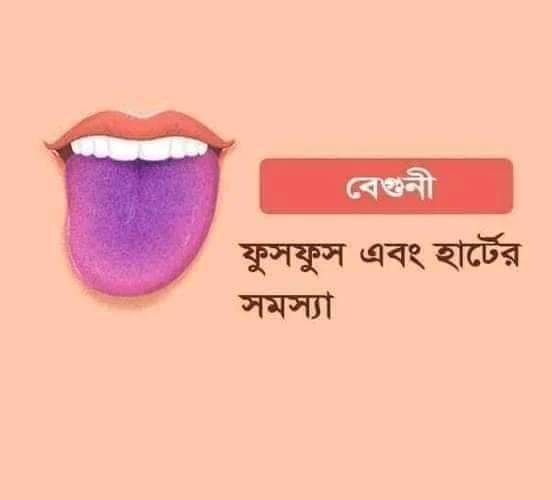 জিহ্বার রং দেখে শারিরীক সমস্যা জানুন