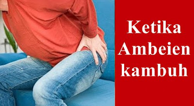 Jual Obat Ambeien De Nature Di Bogor