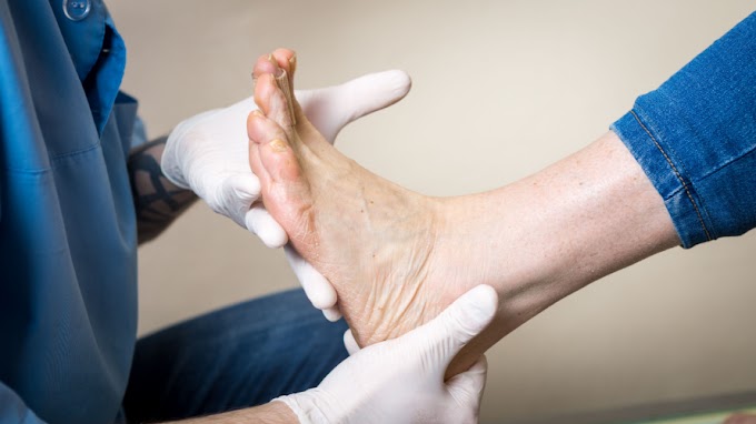 7 Diabetic Foot Problems That Can Lead to Amputation and How to Prevent Them