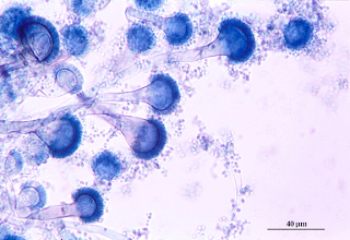 Especies de Polchaco: Aspergillus fumigatus