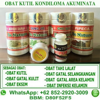 Obat Kutil Kelamin