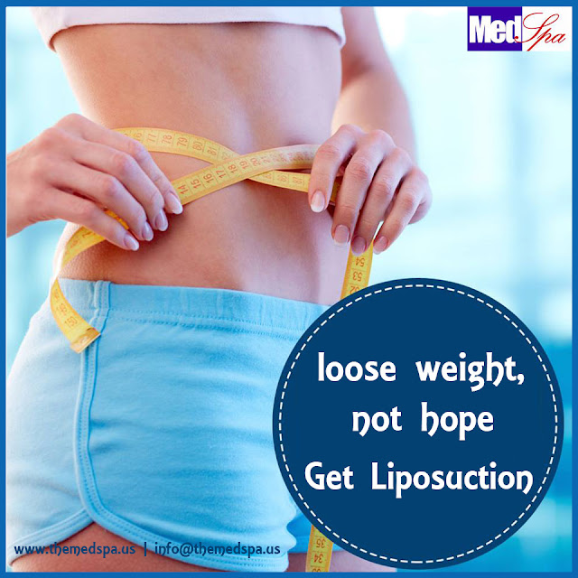 liposuction-weight-loss