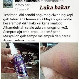 Milagros Untuk Luka Bakar