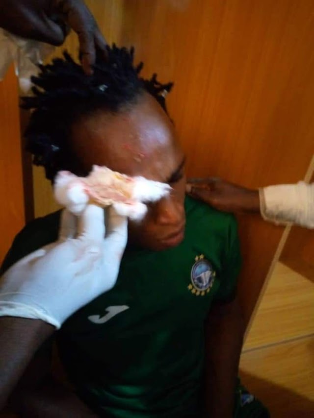 Disturbing Photos of injured Enyimba Players, as they were attacked by Plateau United fans