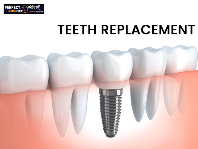 Teeth Replacement in BTM Layout