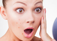 Surprising Causes of Acne You Didn't Know About