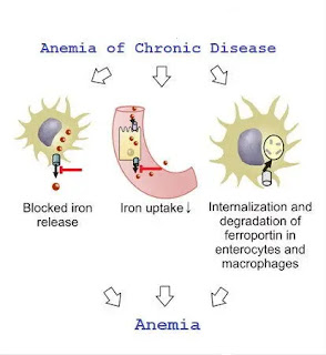 Anemia of chronic disease (ACD)