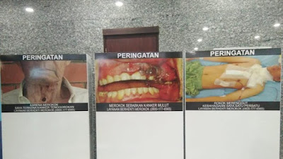 Gambar Seram di Bungkus Rokok Pakai Model Asli Indonesia, Ini Alasannya