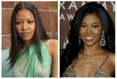 Amerie Nose Job