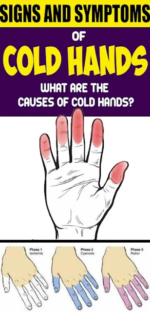 Cold hands: Signs and side effects; What are the reasons for virus hands?