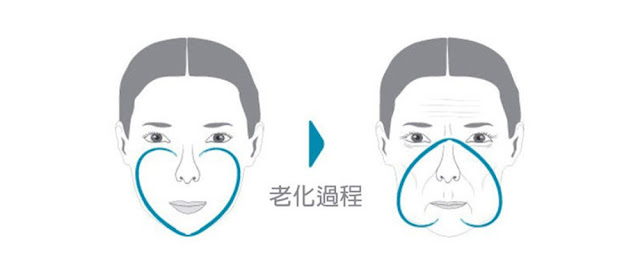 彤顏診所-年輕象徵-心型臉-老化-肌膚鬆弛下垂-倒心型-皺紋-法令紋