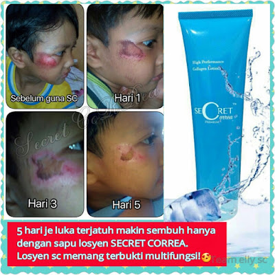 Image result for testimoni secret correa