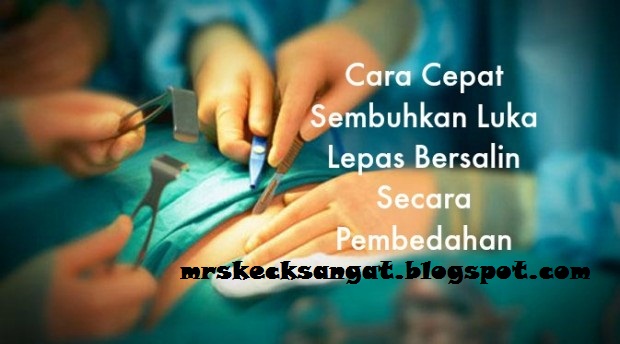 Diari Kecik: Tips Luka Bersalin Cepat Sembuh Dan Kekal 