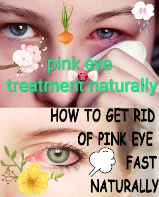 can pink eye go away without treatment