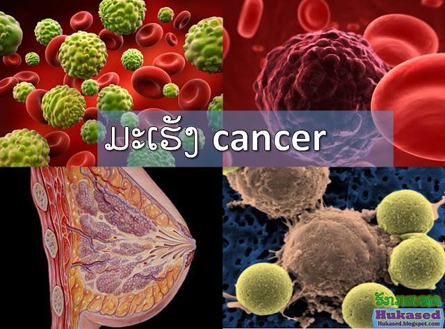 http://hukased.blogspot.com/2017/02/cancer.html