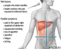 penyebab Penyakit Hepatitis 