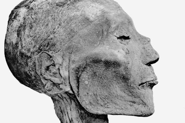 La viruela pudo haber infectado al faraón Ramsés V, esto da entender de que es mucho más antiguo de lo que creíamos