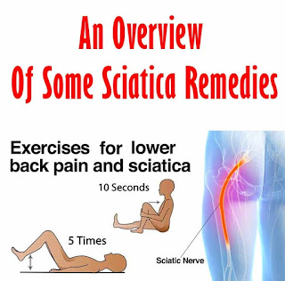 Sciatica Remedies