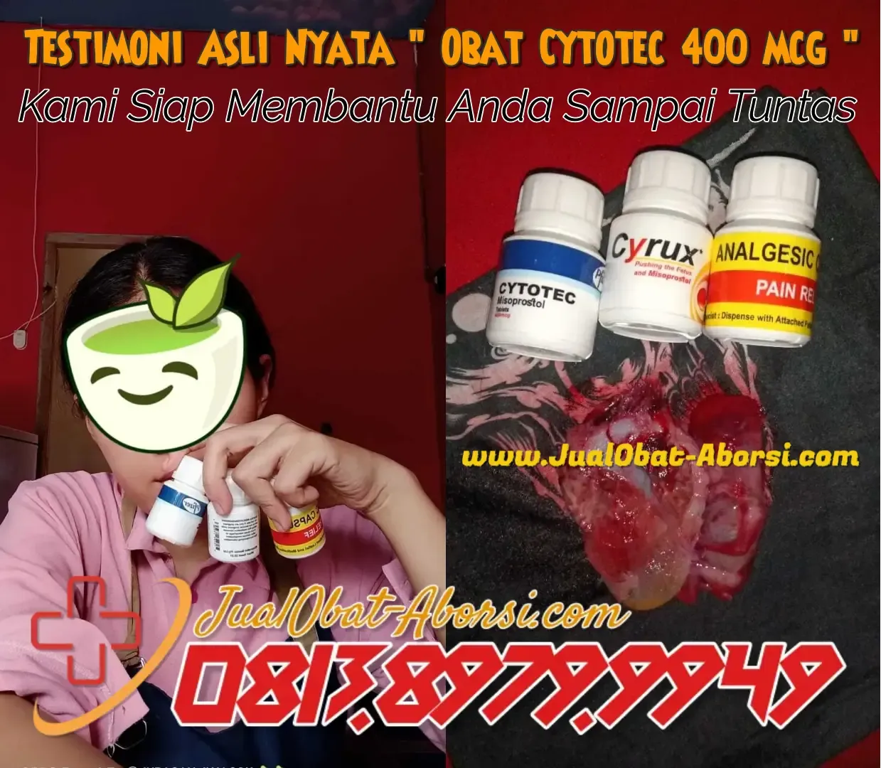 Dapatkan informasi mendalam tentang obat aborsi Cytotec asli 400mcg, efektivitasnya, serta risiko yang harus dipahami untuk keputusan yang lebih baik.