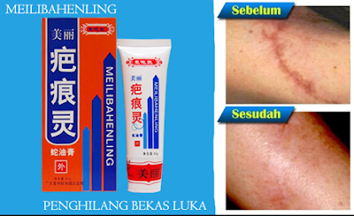 Manfaat dan Harga Cream Obat Meilibahenling di Apotik