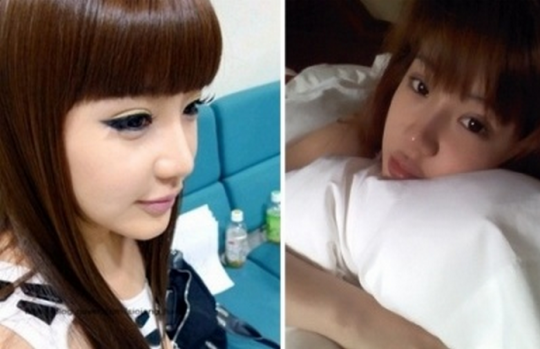 Rahasia Perubahan Drastis Wajah Cantik Barbie Park Bom 2NE1