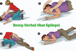 Resep herbal obat penyakit epilepsi