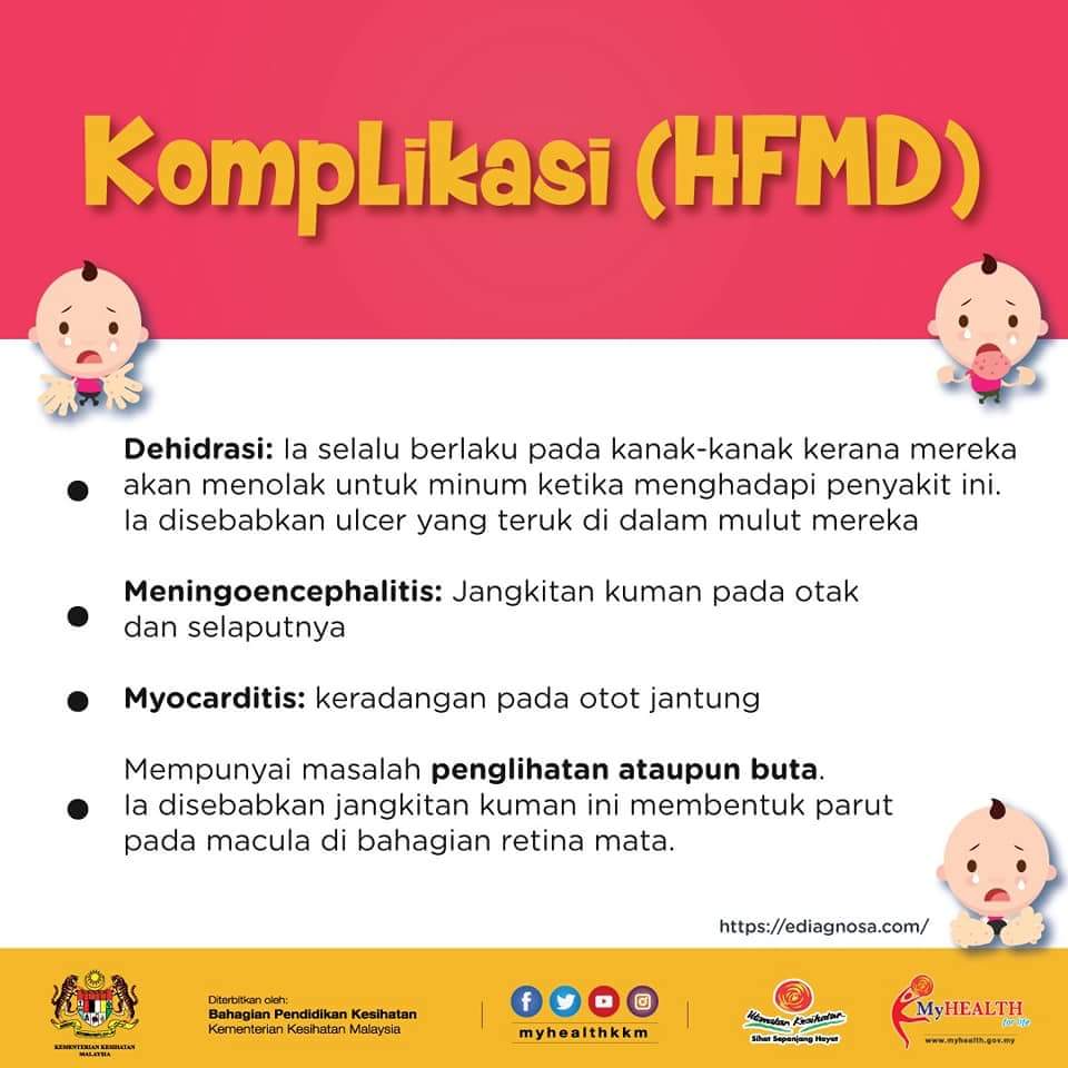 Kisah Kazim Dijangkiti HFMD - nurulshahira.com
