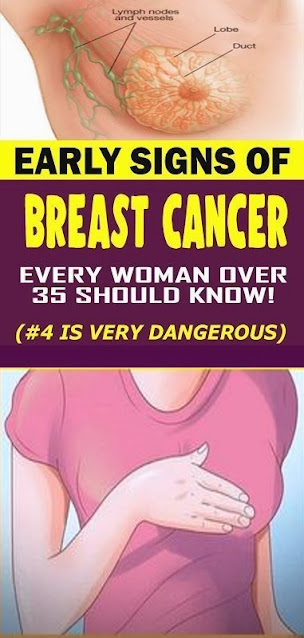 Early Warning Signs Of Breast Cancer Is Growing In Your Body That Most Women Ignore