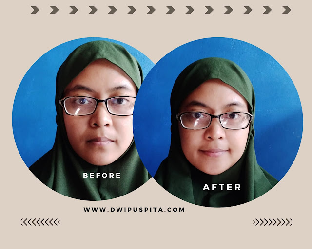 Before after penggunaan green glow maresha skincare