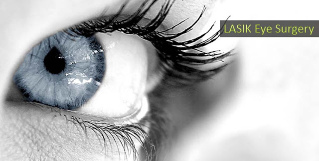 LASIK Eye Surgery readersz.com