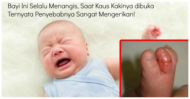 Ibuya Bingung Bayi ini selalu menangis, saat kaus kakinya dibuka ternyata penyebabnya sangat mengerikan!