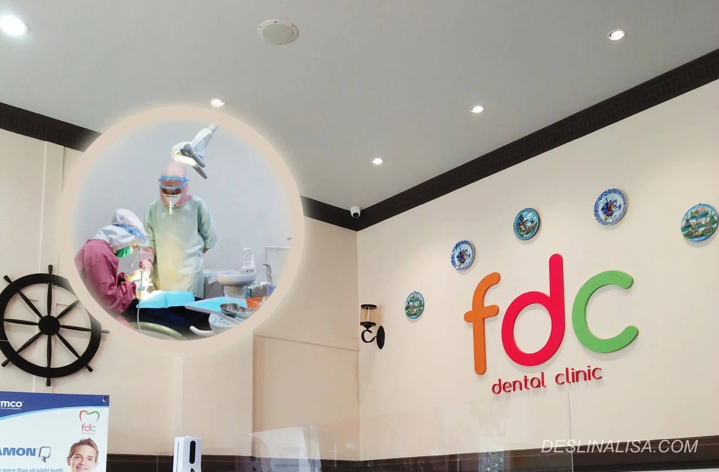 scaling gigi di FDC Dental