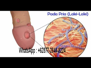 Daftar Obat Sipilis Di Apotik | Obat Sipilis Ampuh Dan Mujarab Di Apotek K24