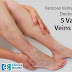 Varicose Veins Specialist Doctor Debunks 5 Varicose Veins Myths