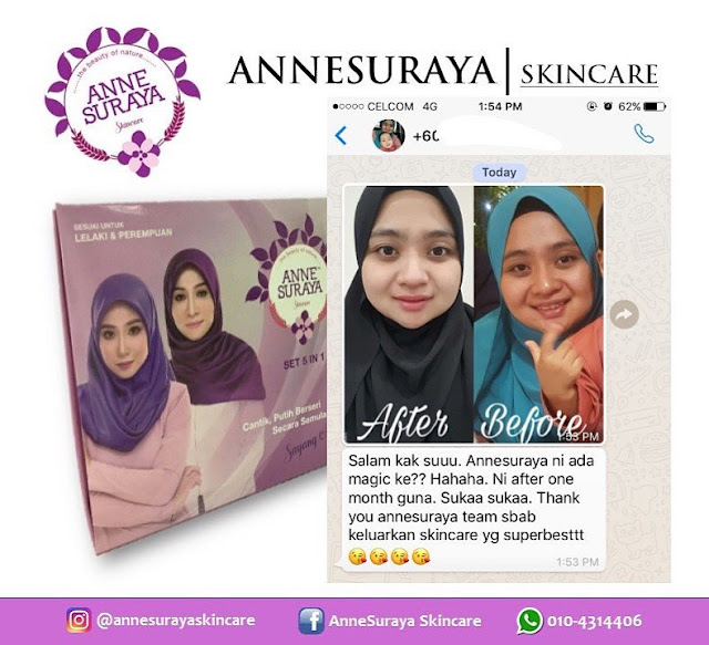 Annesuraya Skincare Menyelesaikan Masalah Kulit Kusam Dan Jeragat