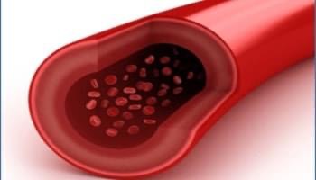  Dhiig yari, Anemia