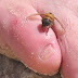 Lavrador morre depois de picado por abelha em Lagoa Real