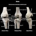 A Marvel Strength Of Bone